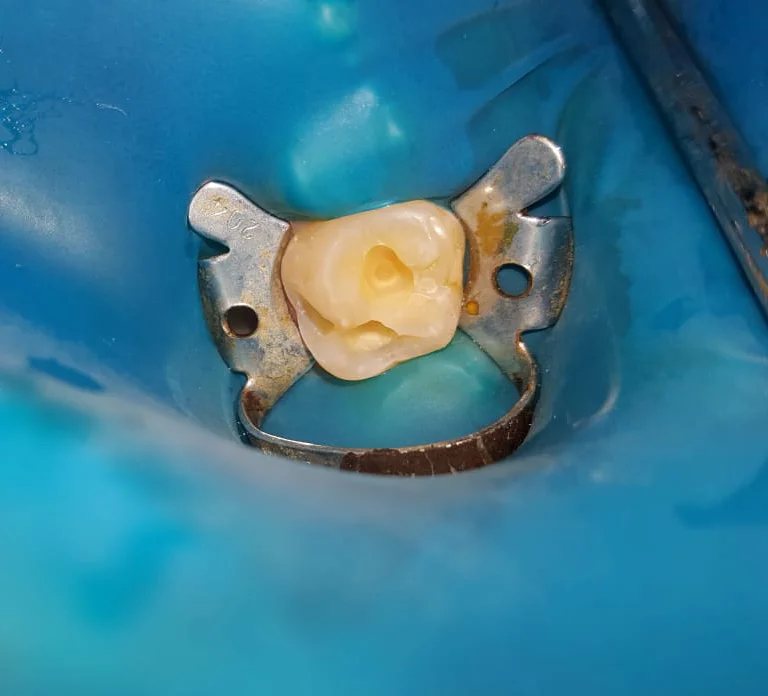 Dental Image