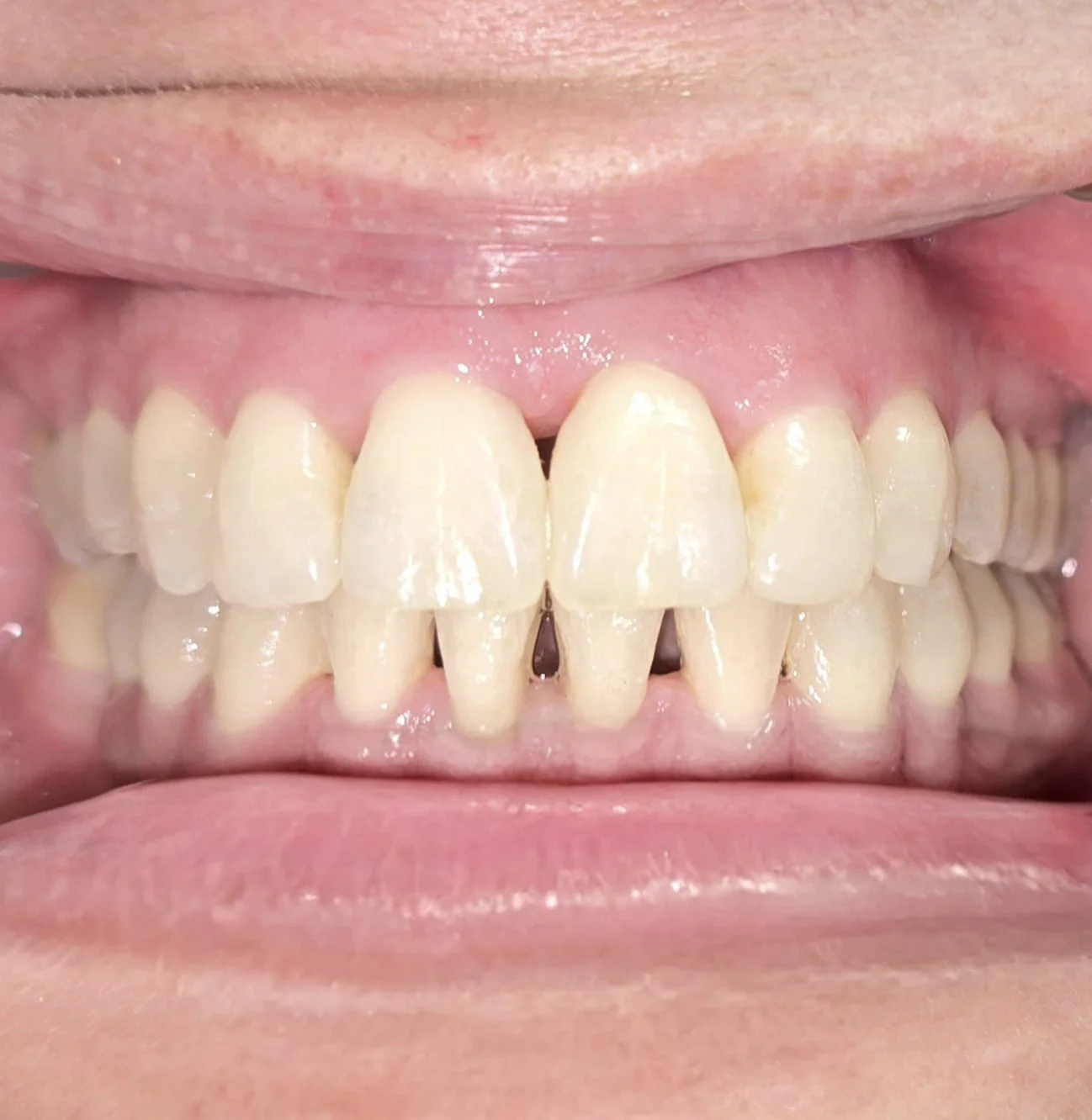 Dental Image